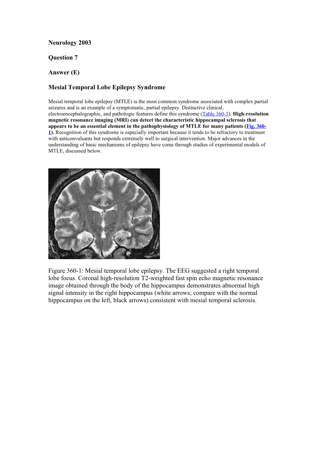 Mesial Temporal Lobe Epilepsy Syndrome