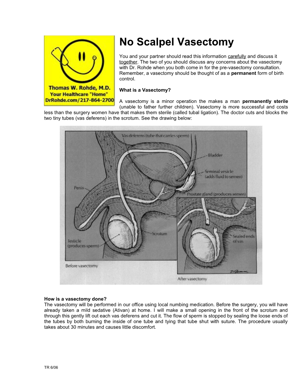 No Scalpel Vasectomy s1