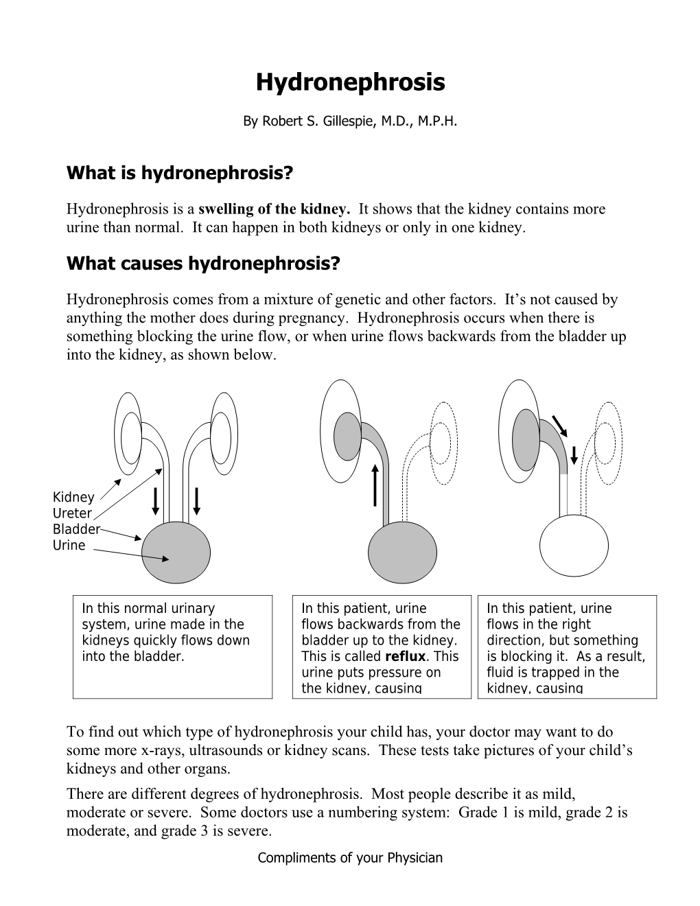 What Is Hydronephrosis?