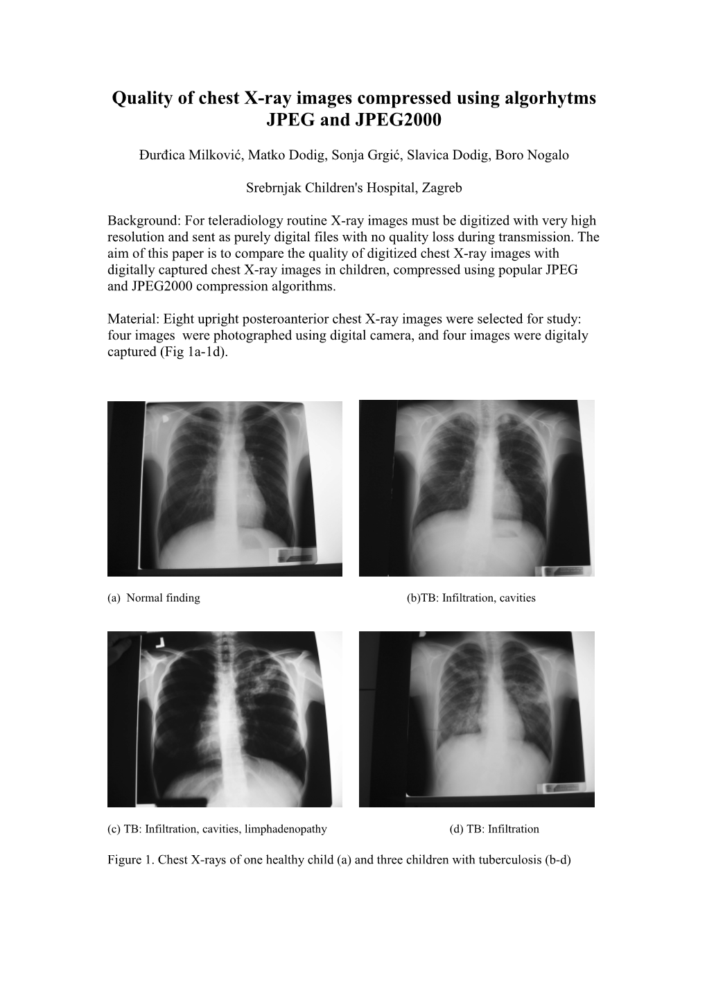 Quality of Chest X-Ray Images Compressed Using Algorhytms JPEG and JPEG2000