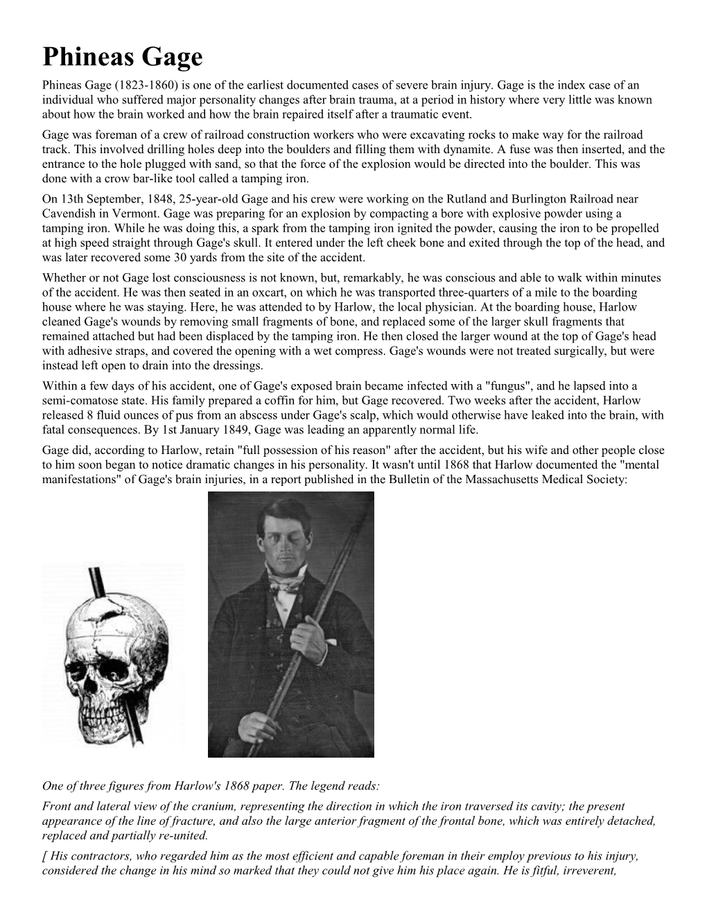 Phineas Gage (1823-1860) Is One of the Earliest Documented Cases of Severe Brain Injury