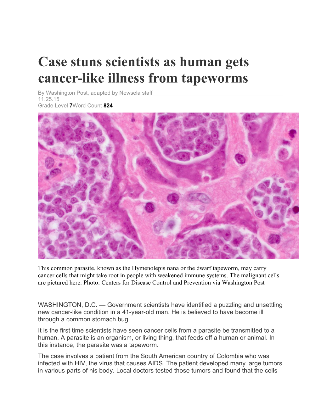 Case Stuns Scientists As Human Gets Cancer-Like Illness from Tapeworms