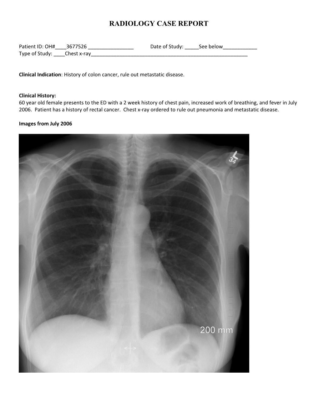 RADIOLOGY CASE REPORT Jeff Praught