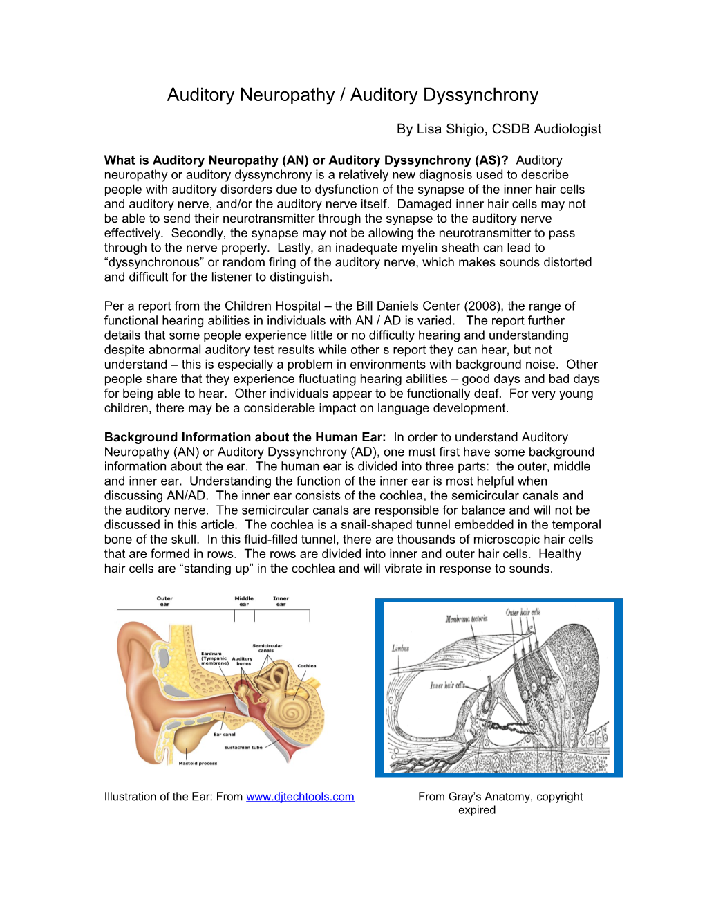 Auditory Neuropathy / Dyssynchrony