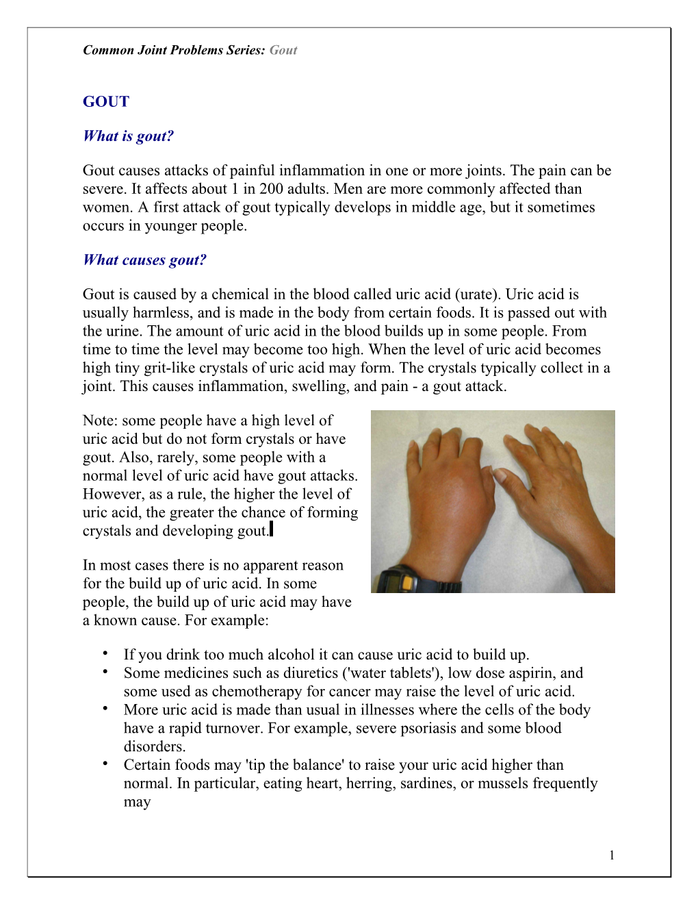 Common Joint Problems Series: Gout