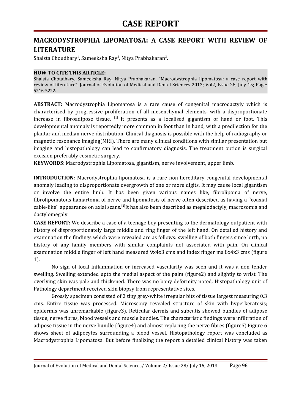 Macrodystrophia Lipomatosa: a Case Report with Review of Literature