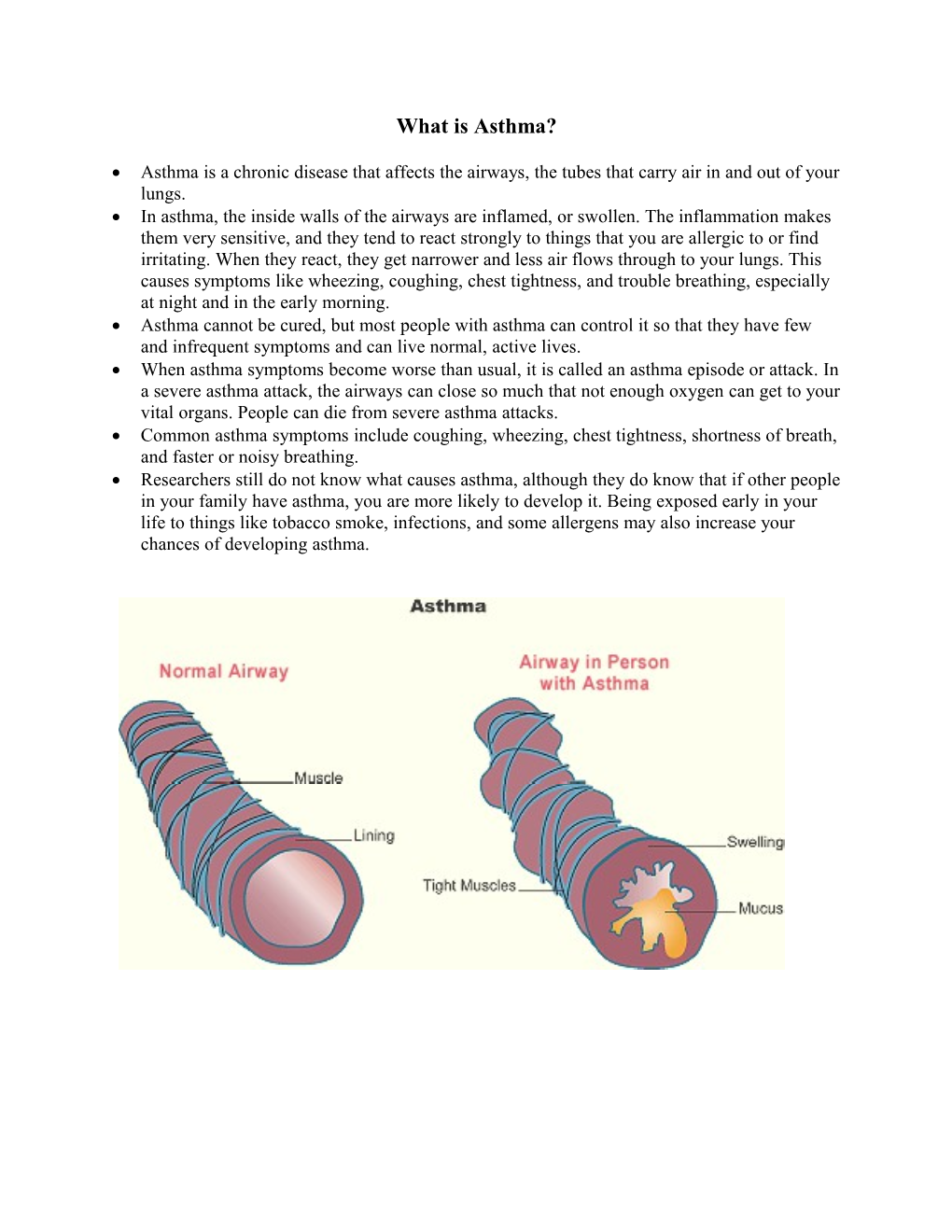 What Is Asthma?