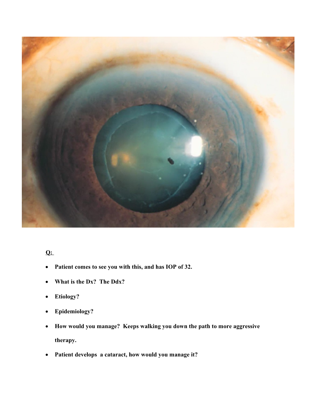 Patient Comes to See You with This, and Has IOP of 32