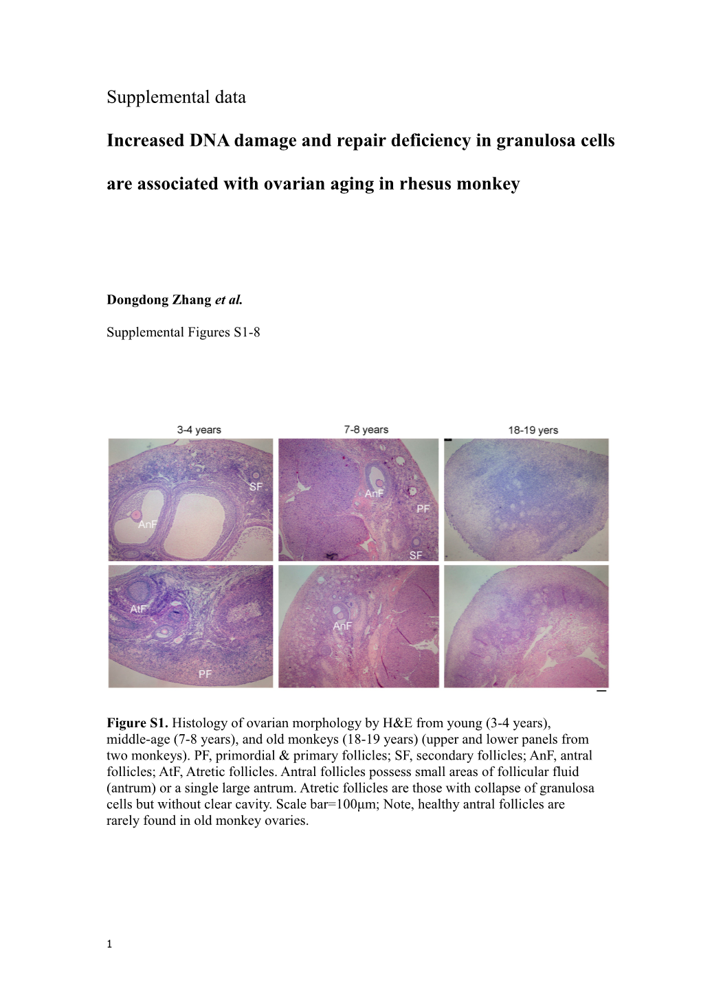 Increased DNA Damage and Repair Deficiency in Granulosa Cells Are Associated with Ovarian