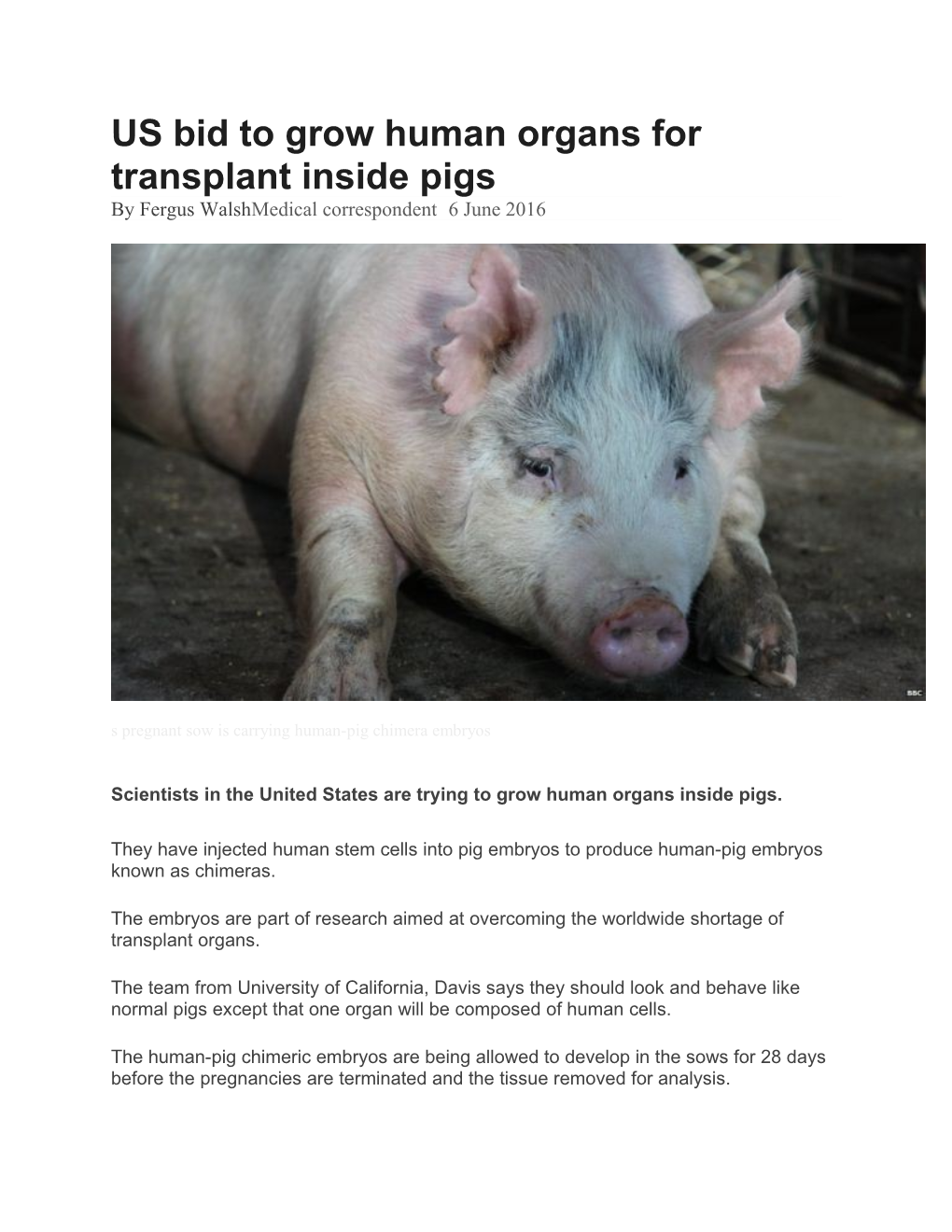 US Bid to Grow Human Organs for Transplant Inside Pigs