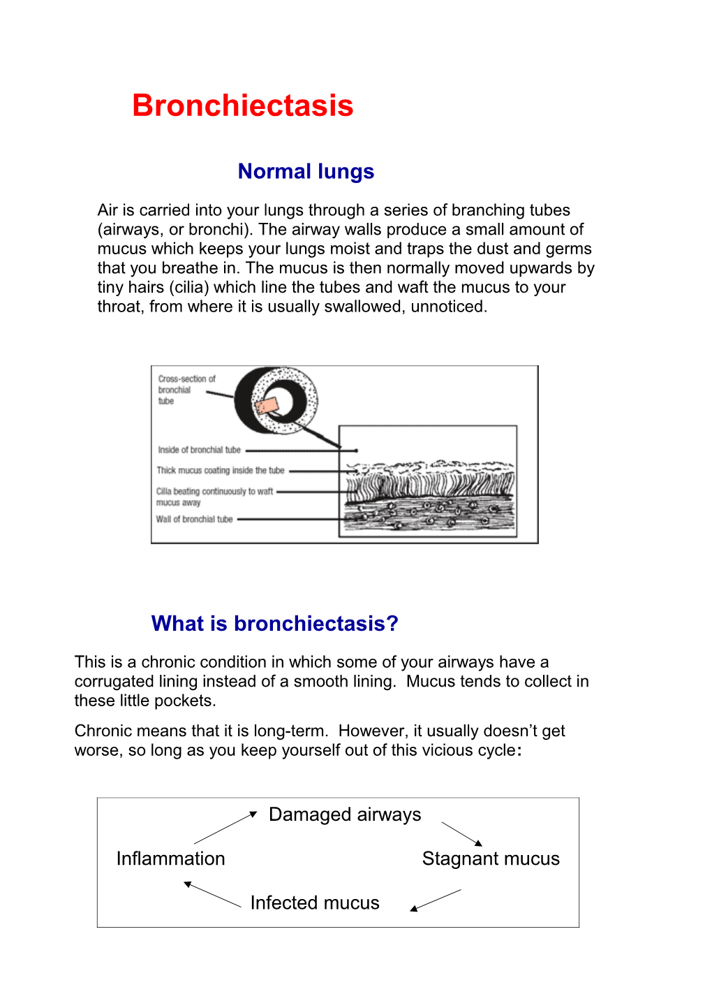 What Is Bronchiectasis?