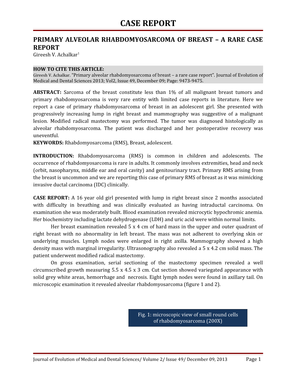 Primary Alveolar Rhabdomyosarcoma of Breast a Rare Case Report