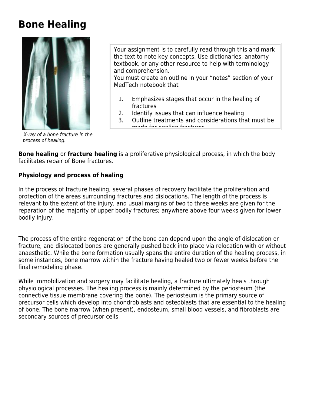 X-Ray of a Bone Fracture in The