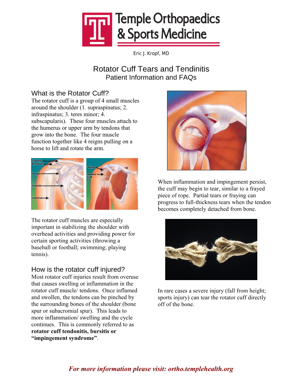 What Is the Rotator Cuff