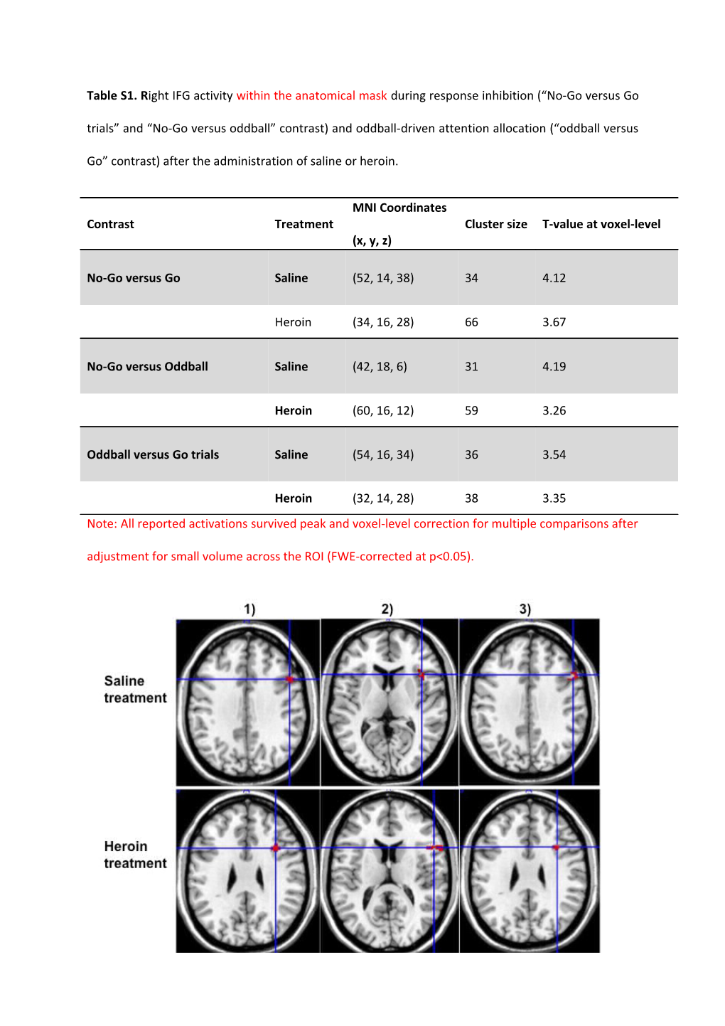 Table S1. Right IFG Activitywithin the Anatomical Maskduring Response Inhibition ( No-Go