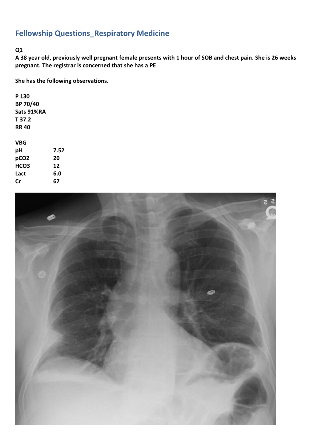 Fellowship Questions Respiratory Medicine