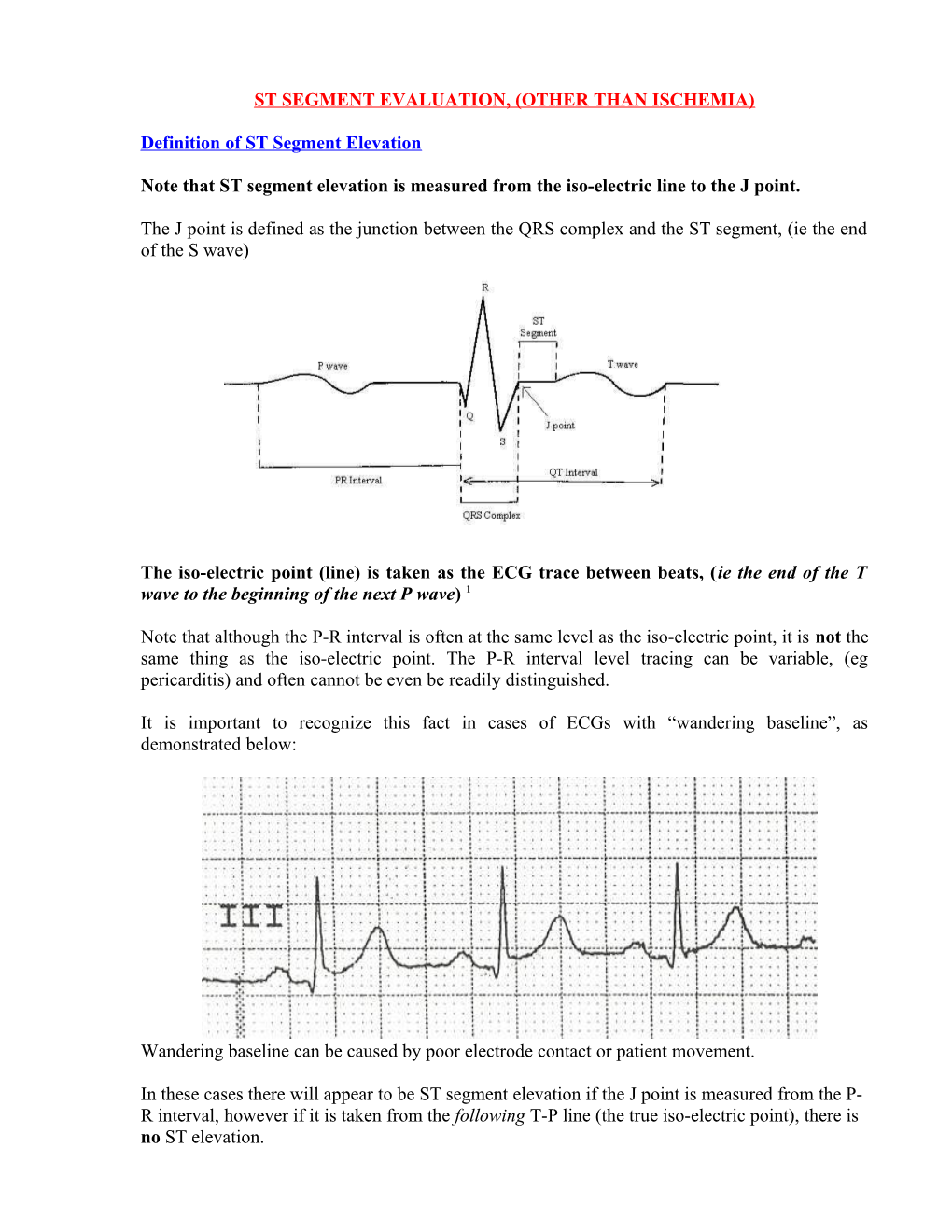 ST Segment Elevation Evaluation