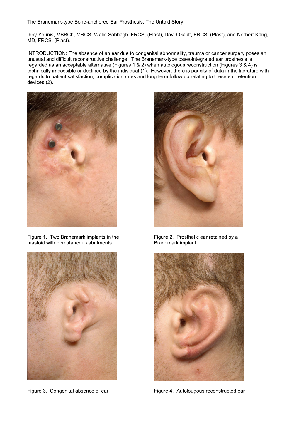 The Branemark-Type Bone-Anchored Ear Prosthesis: the Untold Story