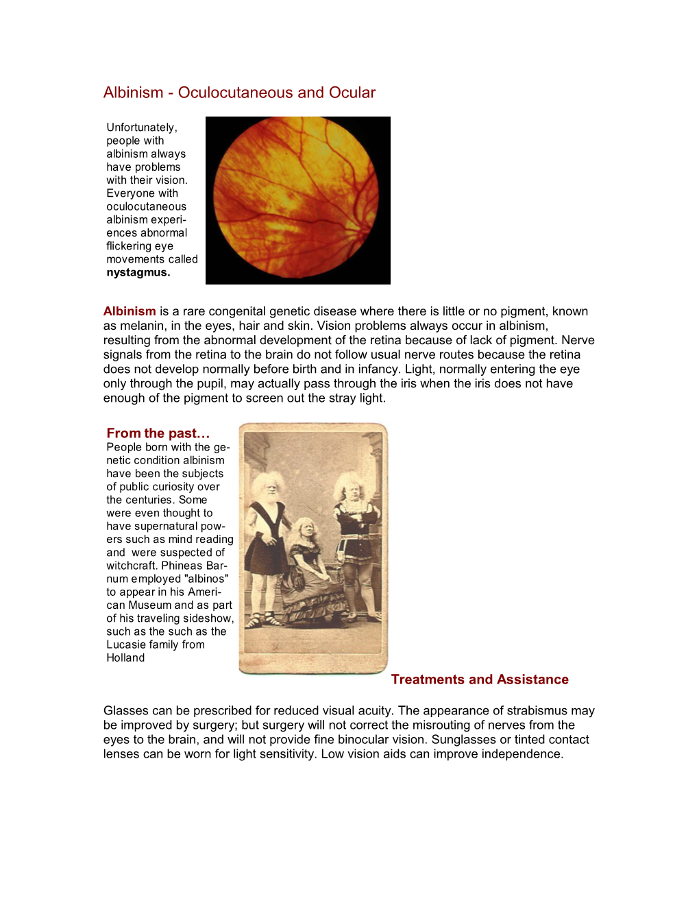 Albinism - Oculocutaneous and Ocular