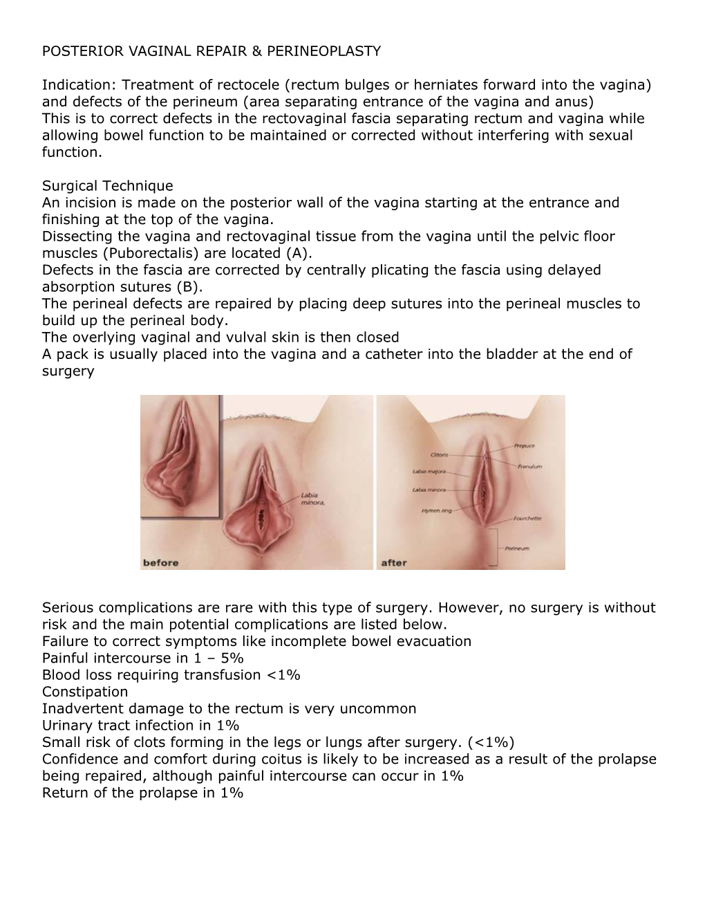 Posterior Vaginal Repair & Perineoplasty