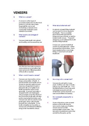 Qwhat Are the Advantages of Veneers?