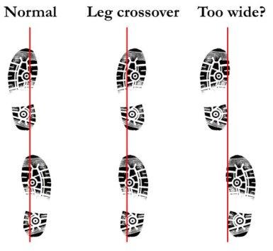 Description Description Description leg crossover runners